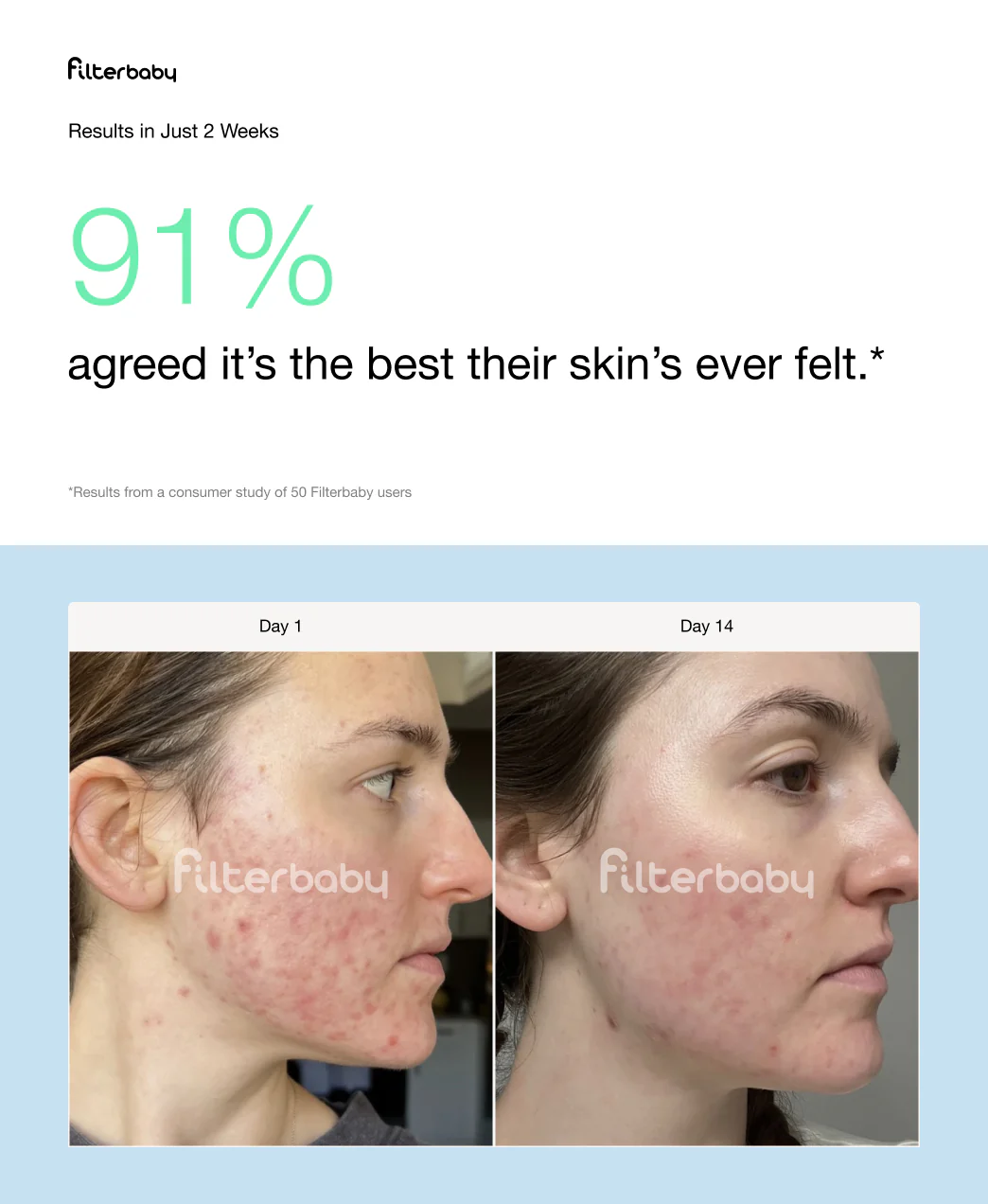 Filterbaby Skincare Filter 2.0 - Image 39