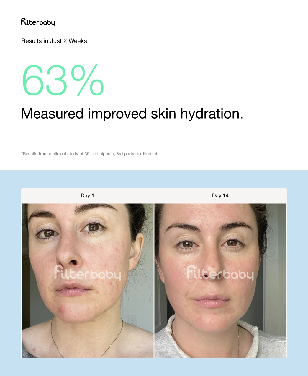 Filterbaby Skincare Filter 2.0 - Image 40